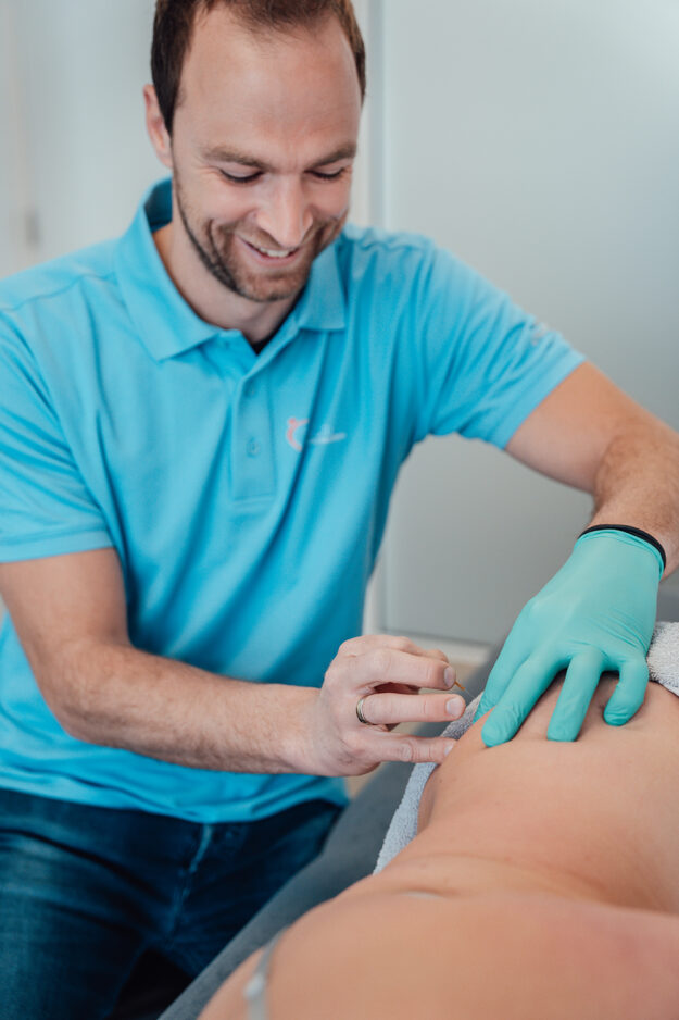 man behandelt ischias doormiddel van dryneedling