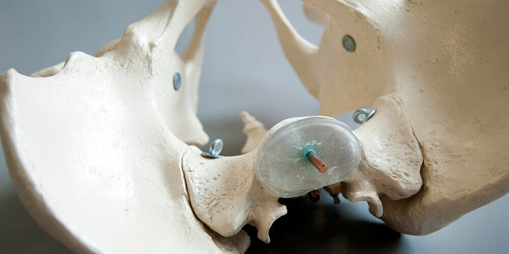 Afbeelding van het bekken voor de vacature bekkenfysiotherapeut