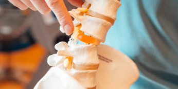 Foto van een therapeut in een blauw shirt wijst naar een model van een wervelkolom om hernia-pijn te ontwijken.