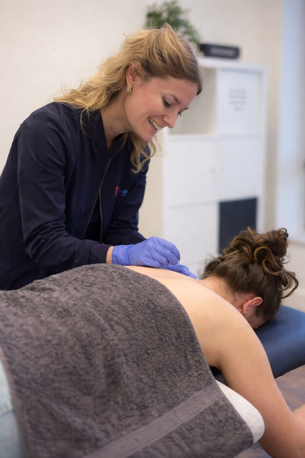 Dry needling in behandelkamer Fysiotherapeut past dry needling toe op bovenrug patient